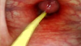 DEEP THROAT ANAL👌 POUNDING: INTIMATE ASS🍑 SHOT & CUM INFUSION