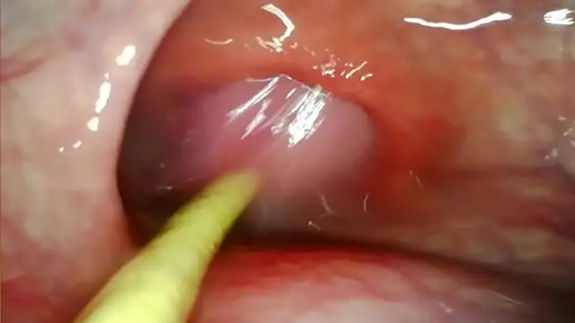 Unleashed Anal👌 Encounter: Extreme Deep DP Thriller with Cumshot Inside