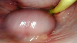 AMAZING INTERNAL POV CAMERA INSIDE HER PUSSY WHILE I FILL HER WITH CUM