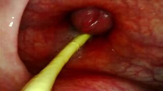EXTREME ANAL POV  CAMERA INSIDE HER ASSHOLE AS I POUND HER WITH MY BIG COCK AND CUM DEEP INSIDE