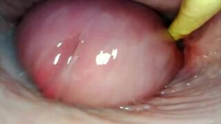 AMAZING INTERNAL POV. CAMERA INSIDE HER PUSSY WHILE I FILL HER WITH CUM
