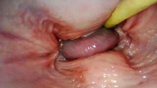AMAZING INTERNAL POV. CAMERA INSIDE HER PUSSY WHILE I FILL HER WITH CUM