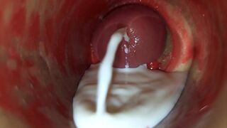 Camera Inside Deep Pussy Captures Huge Ejaculation of Sperm ASMR