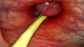 EXTREME ANAL POV. CAMERA INSIDE HER ASSHOLE AS I POUND HER WITH MY BIG COCK AND CUM DEEP INSIDE