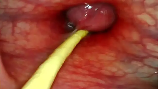 Deep penetration from behind as my cock🌭 slams inside her &mdash;  cumming intensely in the hole