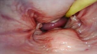 HOT INTERNAL POV  CAMERA INSIDE HER PUSSY WHILE I FILL HER WITH CUM